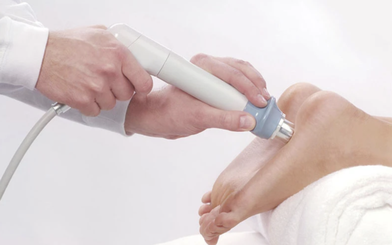 Fala uderzeniowa w leczeniu ostrogi piętowej